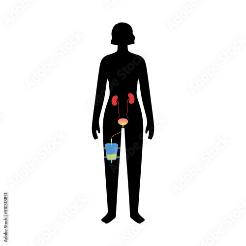 Urinary drainage bag