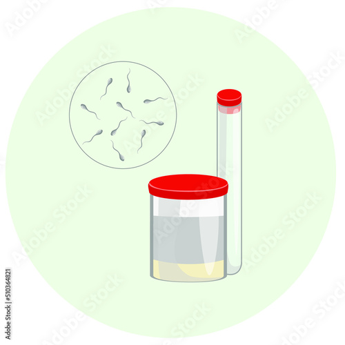 Sperm bank for further in vitro fertilization