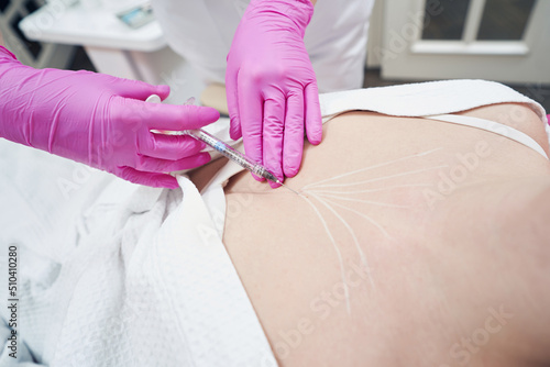 Female client lying on cosmetology chair while receiving skin cell restoration