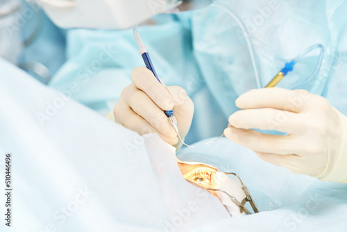 Fotografie Ophthalmology laser microscope operation