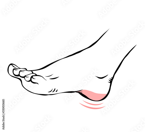 Line sketch female leg with problematic pain. Sore heel. Orthopedic disease plantar fasciitis. Beauty and health of feet. Vector isolated outline illustration