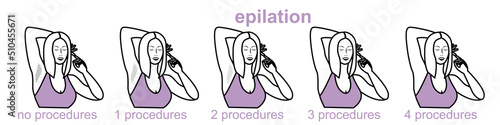 armpit hair removal, arm hair removal, hardware destruction of hair follicles, laser hair removal, sugaring, procedure for women and men