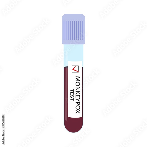 Test tube with a blood sample with a positive test for monkeypox virus close-up isolated on a white background. Vector illustration.