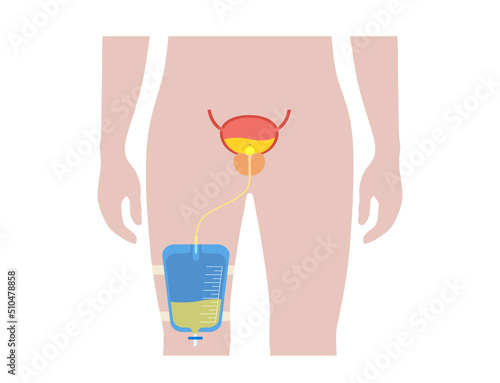 Urinary drainage bag