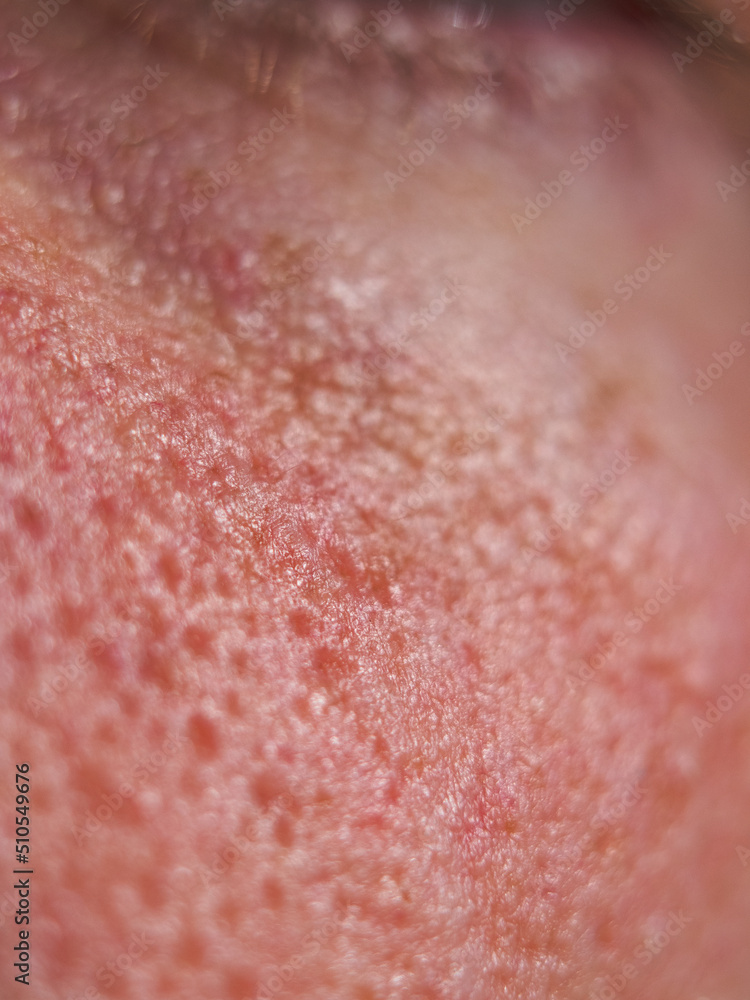 Fototapeta premium close up of skin