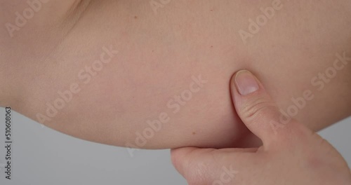 Close up shot of of a woman pinching the skin beneath her arm. Showing her fatty arm which needs to get reduced. No face photo