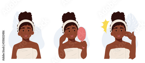 African American woman facial skin problems.acne, pimple.skin care concept.vector flat illustration.