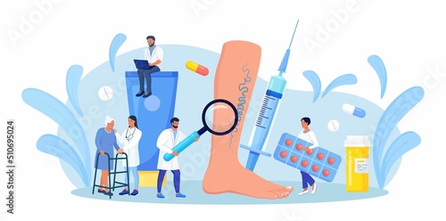 Vein Thrombosis and Varicose Treatment. Tiny Doctor with Magnifying Glass and Drugs around of Huge Foot with Diseased Veins. Elderly Woman came to Specialists for Examination Blood Vessels and Veins. 