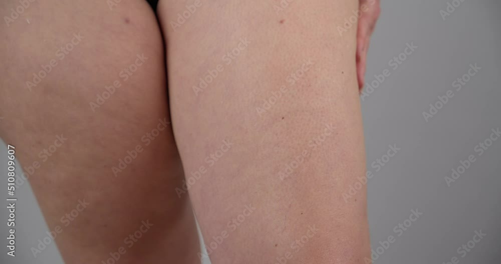 Fat overweight unrecognizable person rubbing thighs to check for cellulite. Slow mo studio shot, gray white background Fat overweight unrecognizable person rubbing thighs to check for cellulite. Slow mo studio shot, gray white background
