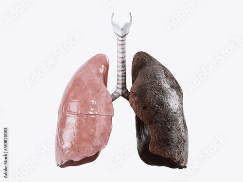 Realistic 3d illustration of healthy human lungs vs smoker lungs isolated on white background. Front view of human lungs before and after smoking 