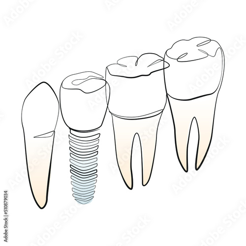 Natural and artificial teeth line art on white isolated background