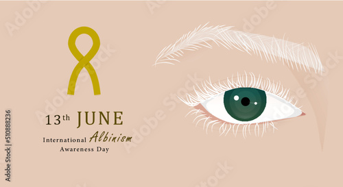 albinism day, 13th June 
hope you like it 3>
