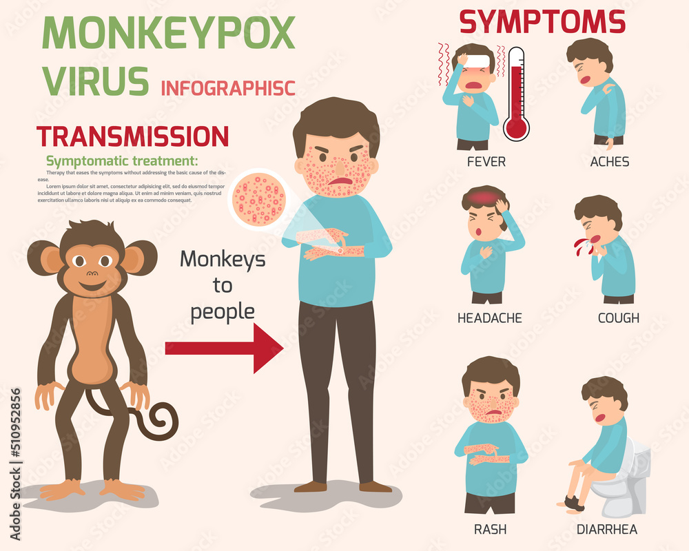 Monkeypox virus infographics elements, Human body with rash. Symptoms