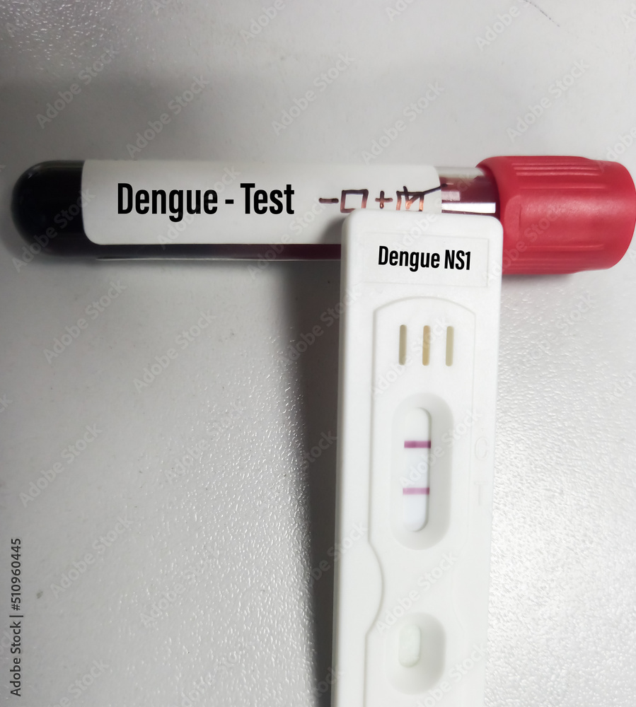 Close view of blood samples with rapid test kit for dengue virus test