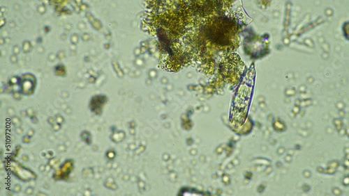 microorganisms and soil biology, with nematodes and fungi under the microscope. in a soil and compost photo