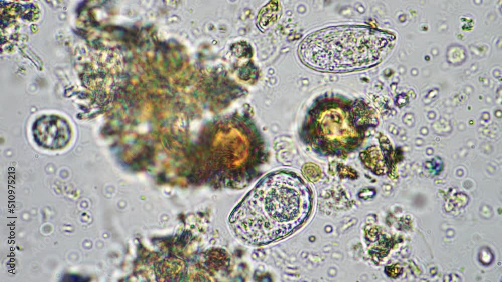 soil microorganisms nematode, microarthropods, micro arthropod ...