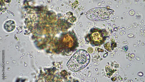 Testate amoebae And flagellate in soil and compost, under the microscope. On a farm in Australia photo