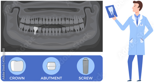 Doctor talking about dental prosthesis structure. Implantation dentistry, stomatology. Tooth care, treatment. Dental implant creation scheme. Sequence of connection of screw, abutment and crown