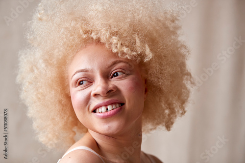 Studio Portrait Shot Of Confident Natural Albino Woman In Underwear Promoting Body Positivity