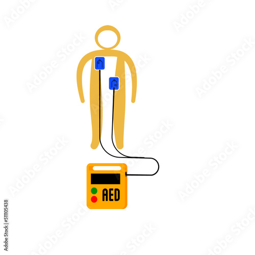 Illustration of an AED or automatic external defibrillator.  Cartoon character, apply pads on pediatric skin.