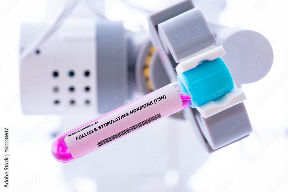 Follicle-stimulating hormone (FSH). Test tube with artificial hormone in robot hand Follicle-stimulating hormone (FSH)