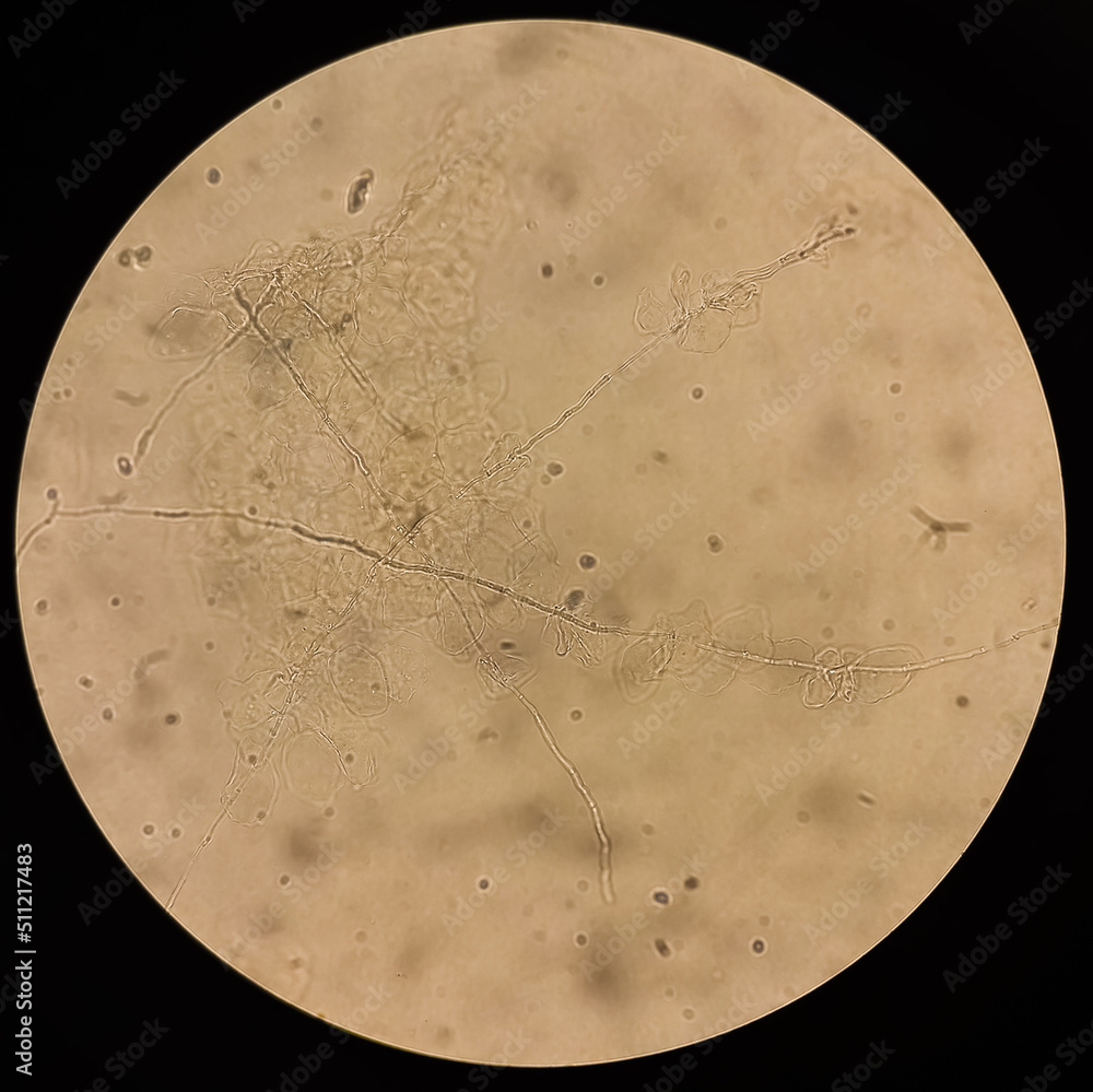 Microscopic view of hyphae of dermatophytes. fungus test. skin scraping
