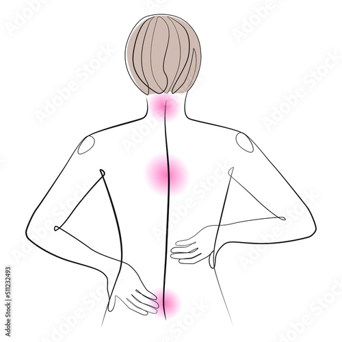 Woman back line art, human spine health on white isolated background. Back pain syndrome vector illustration 