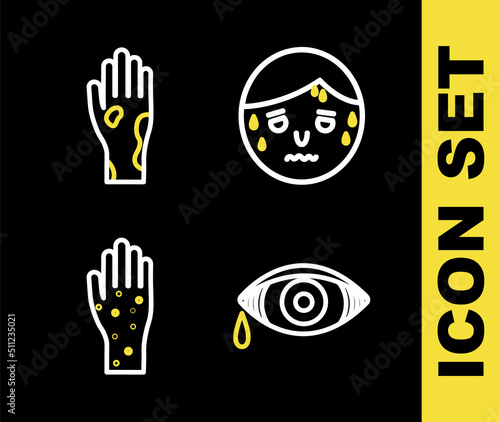 Set line Man with excessive sweating, Reddish eye allergic conjunctivitis, Hand psoriasis or eczema and icon. Vector