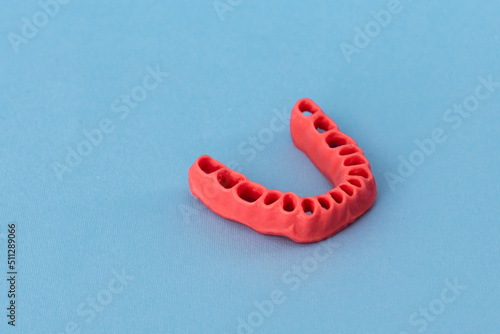 human gums without teeth model medical implant isolated on blue background. Healthy teeth, dental care and orthodontic concept.