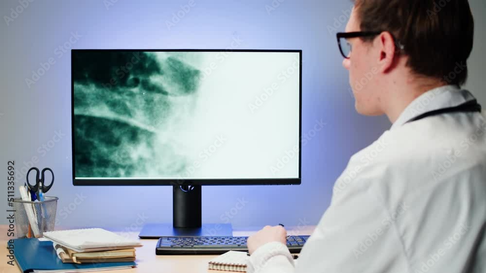Healthcare and medicine. Doctor examining lungs x-ray close-up. Male therapist looking at ribs roentgen on computer monitor, human chest, checkup. Healthcare and medicine. Doctor examining lungs x-ray close-up. Male therapist looking at ribs roentgen on computer monitor, human chest, checkup.
