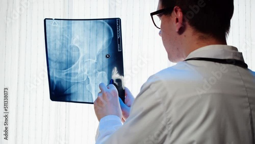 Doctor examining pelvis hip x-ray close-up. Magnetic Resonance Image of human leg. Man nurse looking at xray of foot bones. Healthcare and medicine concept. photo