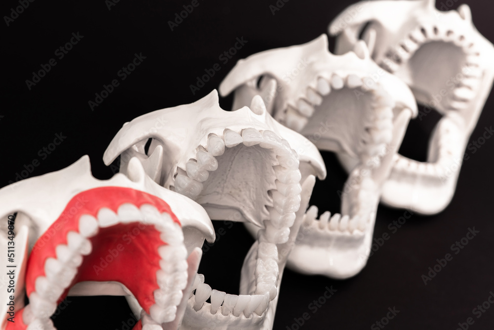 Obraz premium Dentist orthodontic teeth implants models with jaws opened on black background.