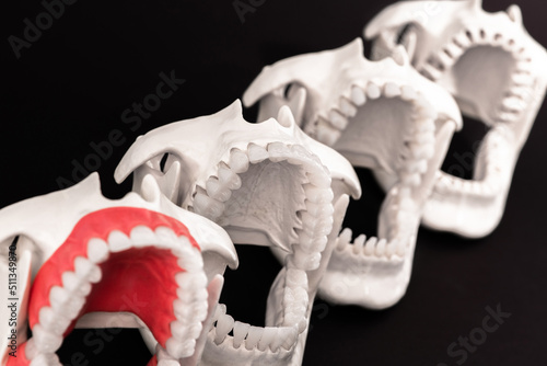 Dentist orthodontic teeth implants models with jaws opened on black background.