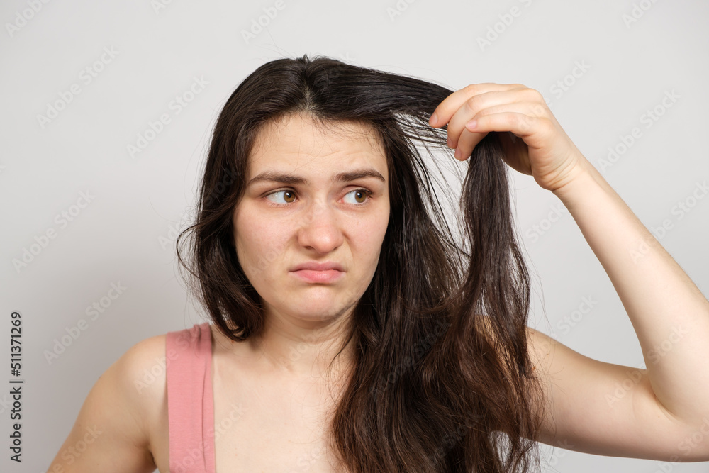 A beautiful brunette woman without makeup with dirty oily hair holds her hands on her head with a dissatisfied look A beautiful brunette woman without makeup with dirty oily hair holds her hands on her head with a dissatisfied look