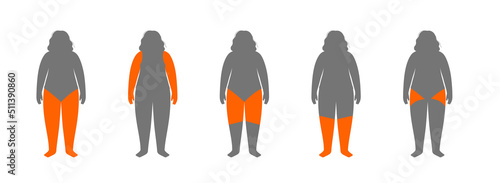 Overweight problem concept