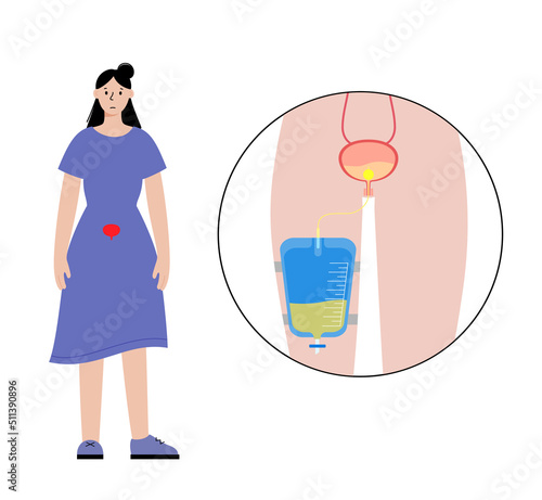Urinary drainage bag