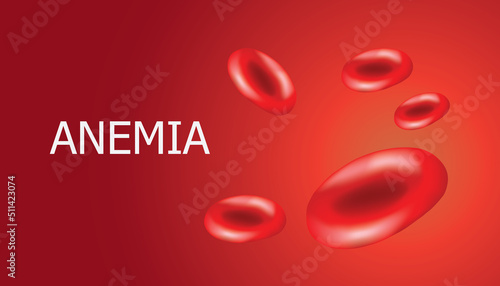 Anemia realistic vector, Red blood cells 3d mock up design. with text space