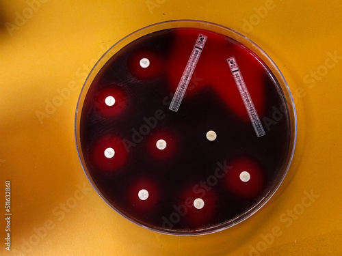 Antibiotic susceptibility testing - agar plate with discs and E-Test strips
