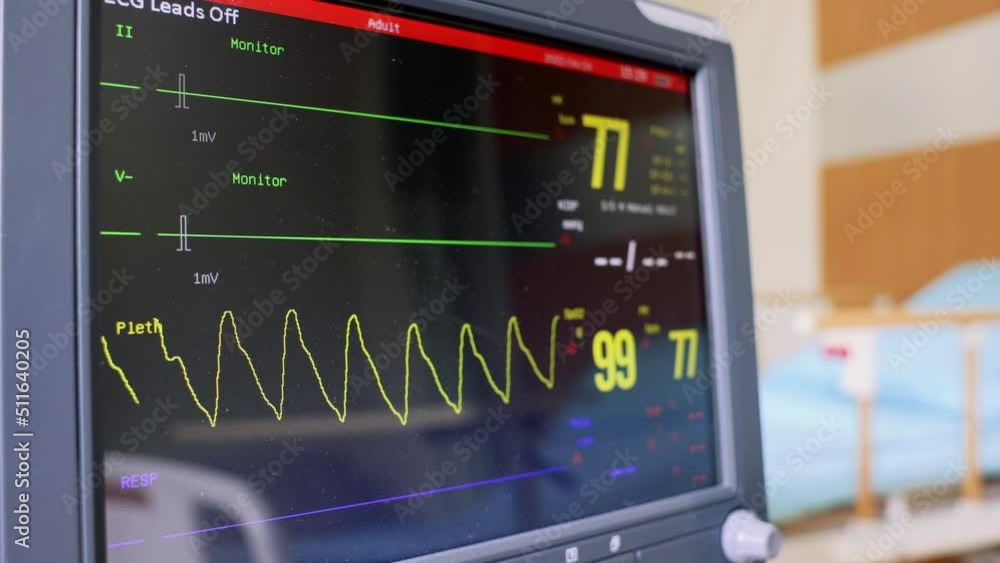 Electrocardiogram, EKG, heart rate monitor in hospital room for checking heart rate hospitalized patients Electrocardiogram, EKG, heart rate monitor in hospital room for checking heart rate hospitalized patients