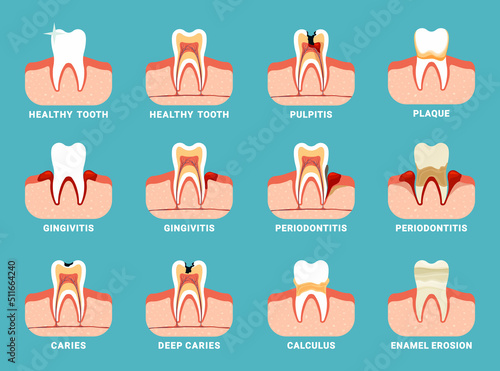 dental problems. different teeth damaged oral bad breath dental care information. Vector flat templates