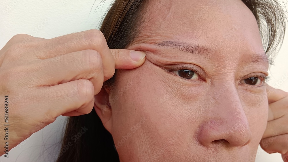 Obraz premium A woman's face has wrinkles.