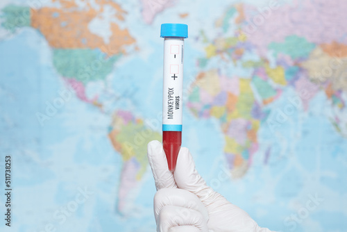 monkeypox test tube in front of map photo