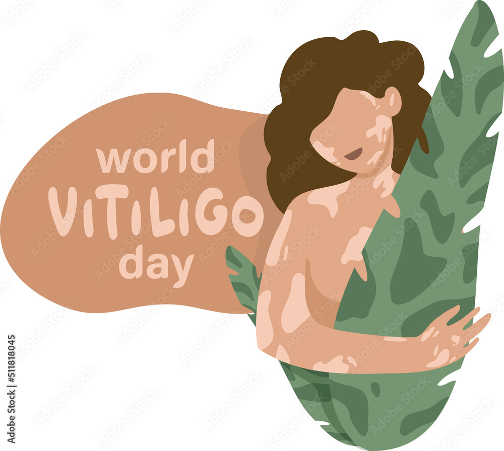 Portrait of woman with leaves with skin vitiligo. Body positive concept. World vitiligo day. 25 june Portrait of woman with leaves with skin vitiligo. Body positive concept. World vitiligo day. 25 june