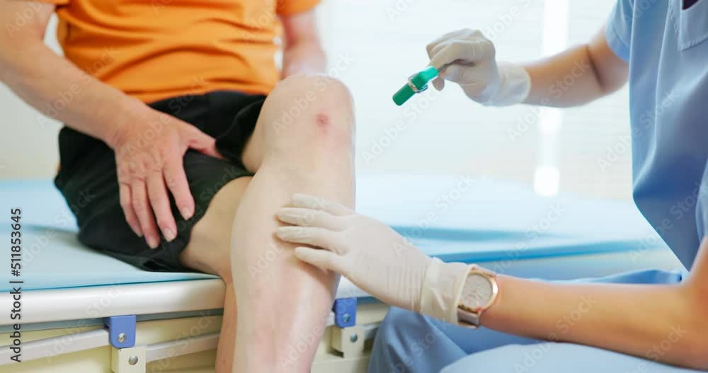 doctor examining patient knee doctor examining patient knee