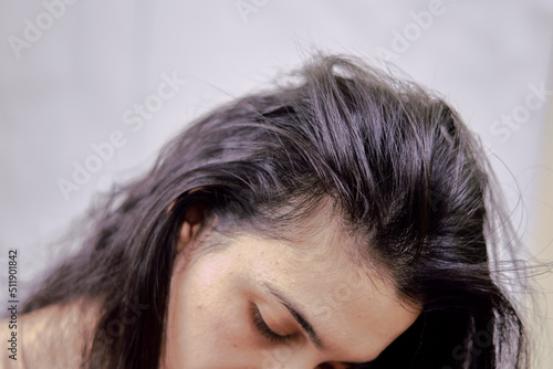 treatment of hair loss, injection for hair growth. Injected in woman's head, hair mesotherapy