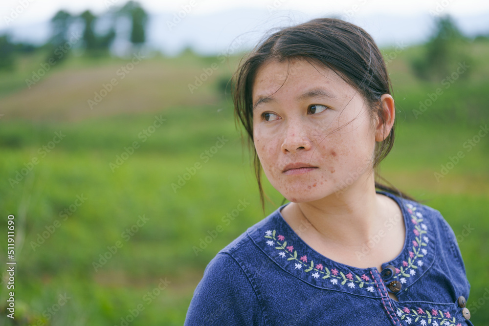 A local woman stands in a cornfield in the dark rainy season. A local woman stands in a cornfield in the dark rainy season.