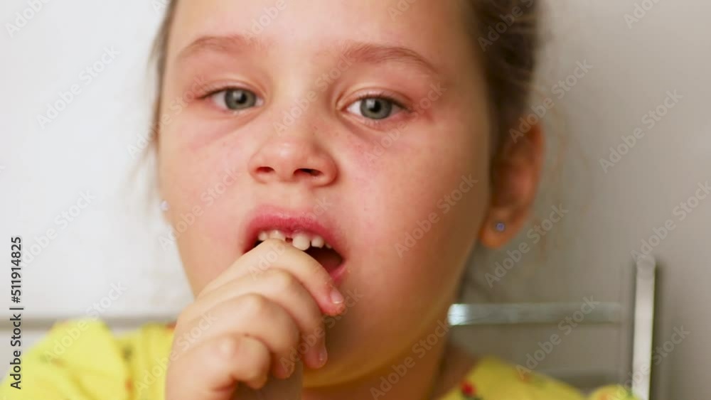Little girl with tearful eyes shaking loose tooth with finger closeup