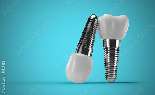 Fototapeta Naklejka Na Ścianę i Meble -  dental implants on a blue background. 3d rendering