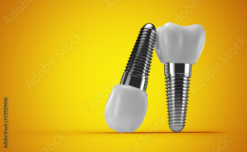 Fototapeta Naklejka Na Ścianę i Meble -  dental implants on a yellow background. 3d rendering