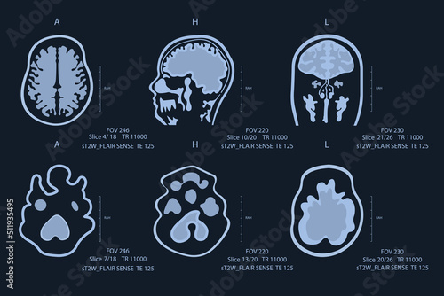 Elderly man brain scan image on MRI magnetic resonance imaging film for neurological medical diagnosis of brain diseases.